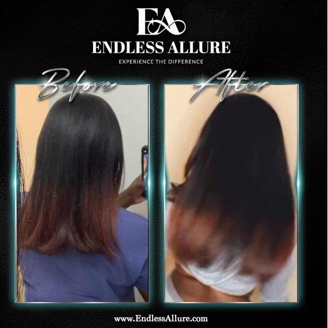 3 Step Hair Growth System