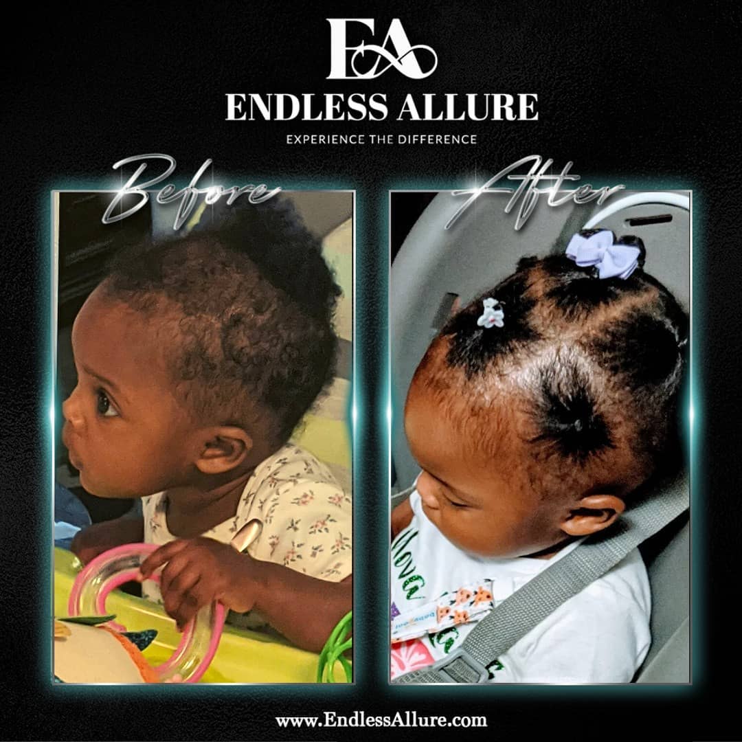 3 Step Hair Growth System