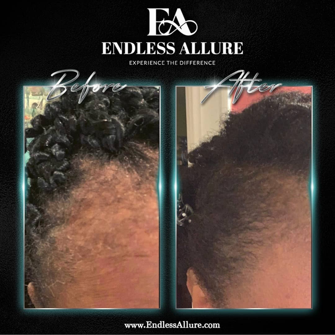 3 Step Hair Growth System