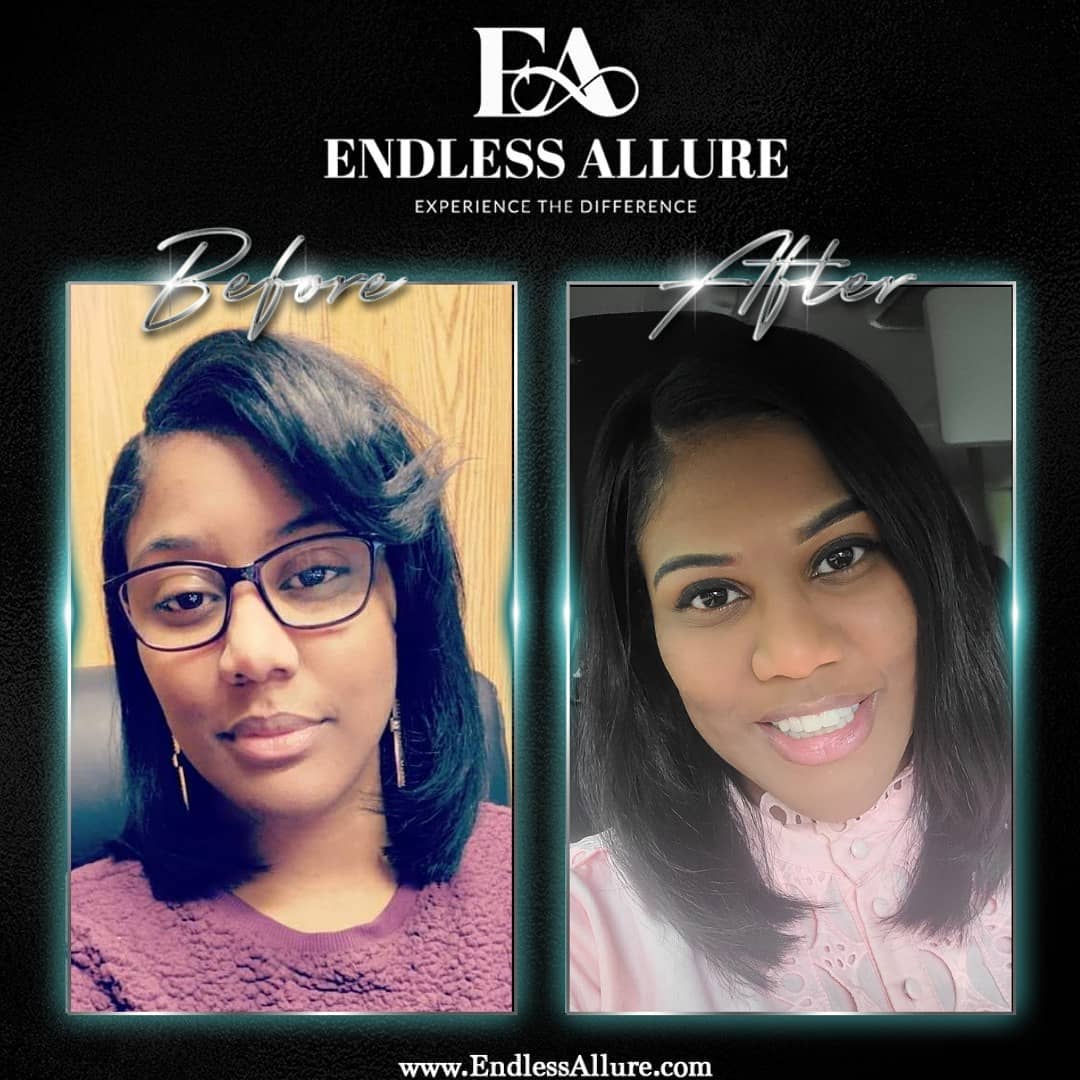 3 Step Hair Growth System