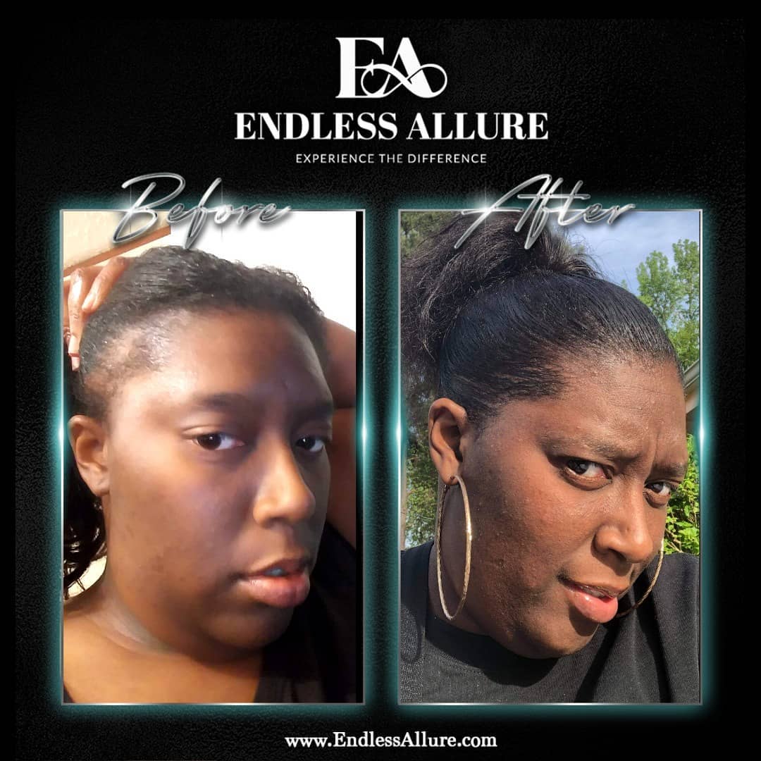 3 Step Hair Growth System