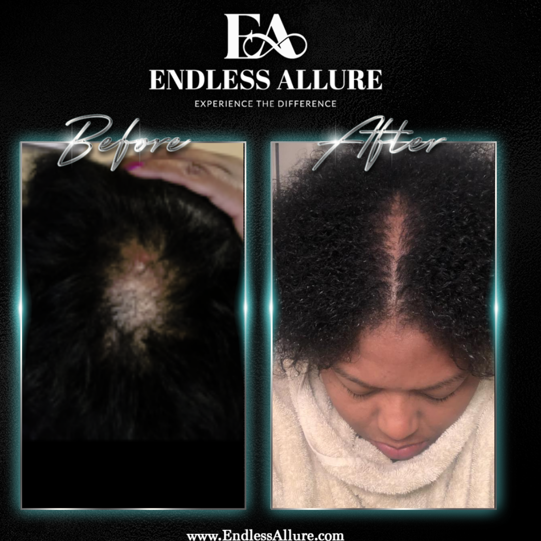 3 Step Hair Growth System