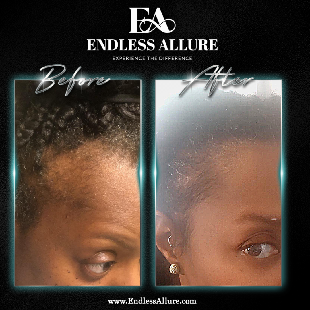 3 Step Hair Growth System