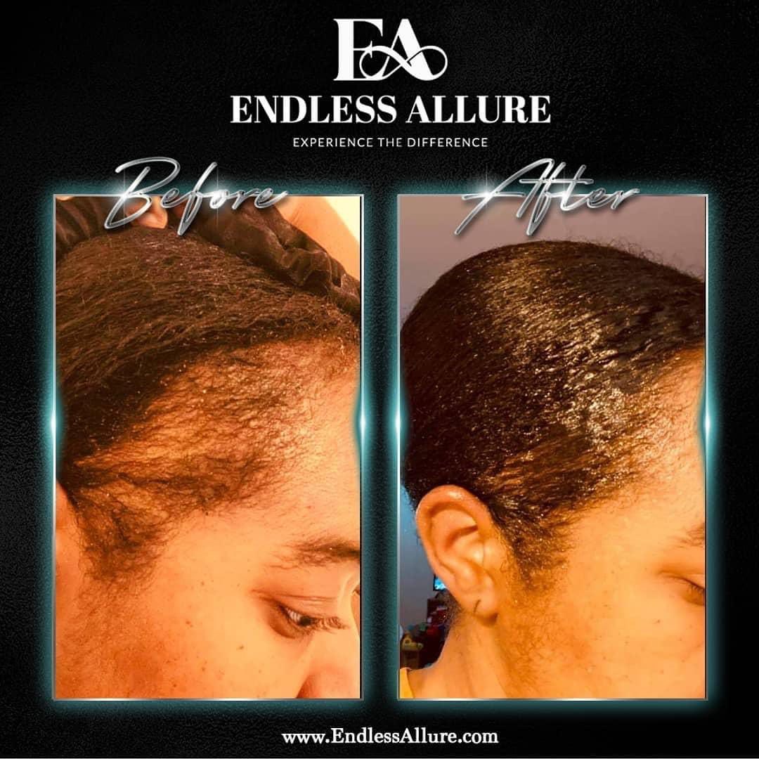 Stimulating Hair Oil