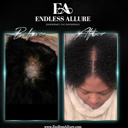 3 Step Hair Growth System